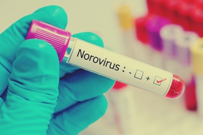 UK health authorities warn of potential second norovirus wave