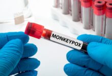 South Africa reports three new cases of monkeypox