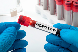 South Africa reports three new cases of monkeypox