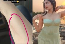 Adah Sharma hilariously ‘sliced’ her hand with ‘dabba ka dhakkan’