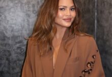 Why Chrissy Teigen says she’s gonna have the ‘worst black eye’?