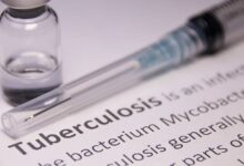 WHO in Western Pacific urges action to end tuberculosis by 2030