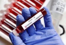 K’taka Health Ministry issues advisory, says sharp rise in Covid cases in Bengaluru in 20 days