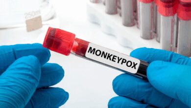 Over 1,800 mpox deaths reported in Africa amid health emergencies