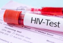 Zimbabwe records increase in AIDS-related deaths, says Health Ministry