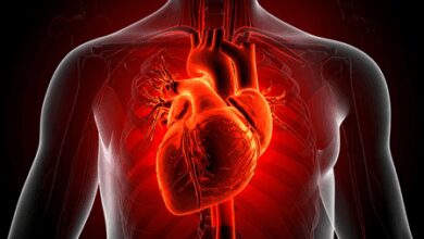 US researchers develop AI model improving sudden cardiac death prediction