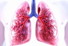 Sri Lanka reports up to 9,500 tuberculosis cases annually