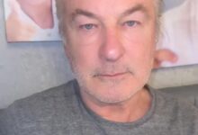 Alec Baldwin’s son, Leo split his forehead open during vacation