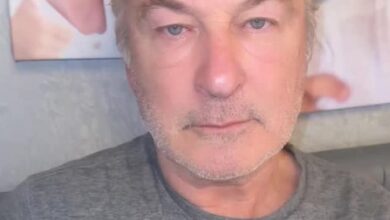 Alec Baldwin’s son, Leo split his forehead open during vacation