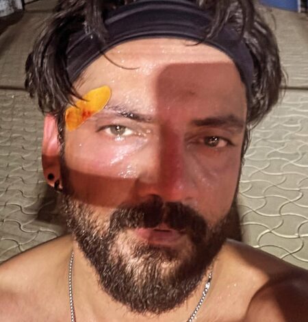 Zaheer Iqbal suffers injury while playing padel Zaheer Iqbal suffers injury while playing padel