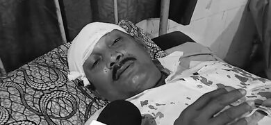 ‘Trinamool miscreants hit me on head with rod’: BJP polling agent in Bengal’s Nadia