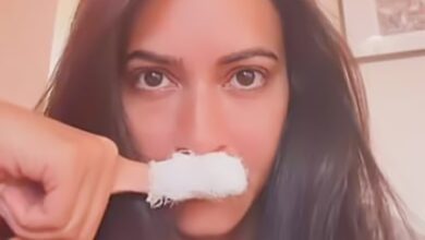 Kriti Kharbanda gets injured during her vacation, says ‘this is how it is going’