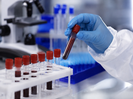 K’taka on high alert after WHO declares Ebola outbreak global health emergency