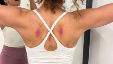 Taapsee Pannu shares glimpse of bruised back after working out on rough floor
