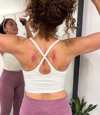 Taapsee Pannu shares glimpse of bruised back after working out on rough floor