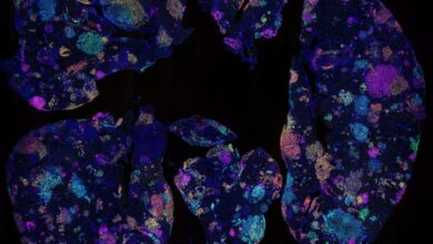 Australian study identifies early blood marker for lung cancer risk