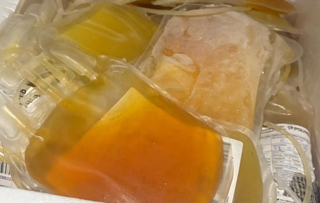 Gujarat: Adulterated plasma seized, declared ‘unfit for human use’; probe extends to Maha blood banks