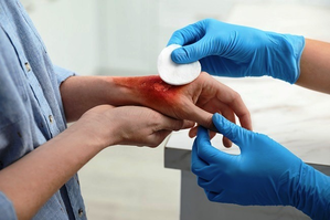 CSIR-IICT to promote surgical adhesive for rapid wound closure CSIR-IICT to promote surgical adhesive for rapid wound closure