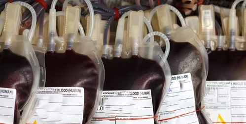 Three laboratory assistants in Bengal hospital arrested for black marketing of blood