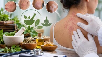 Govt unveils standard treatment protocols for dermatological disorders Govt unveils standard treatment protocols for dermatological disorders